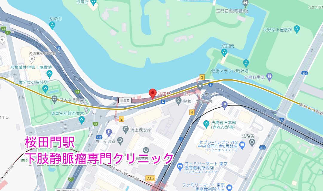 桜田門駅周辺の下肢静脈瘤専門クリニック