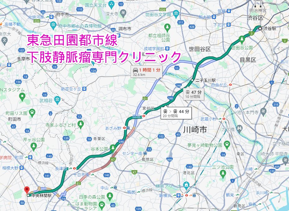 東急田園都市線沿線の下肢静脈瘤専門クリニック