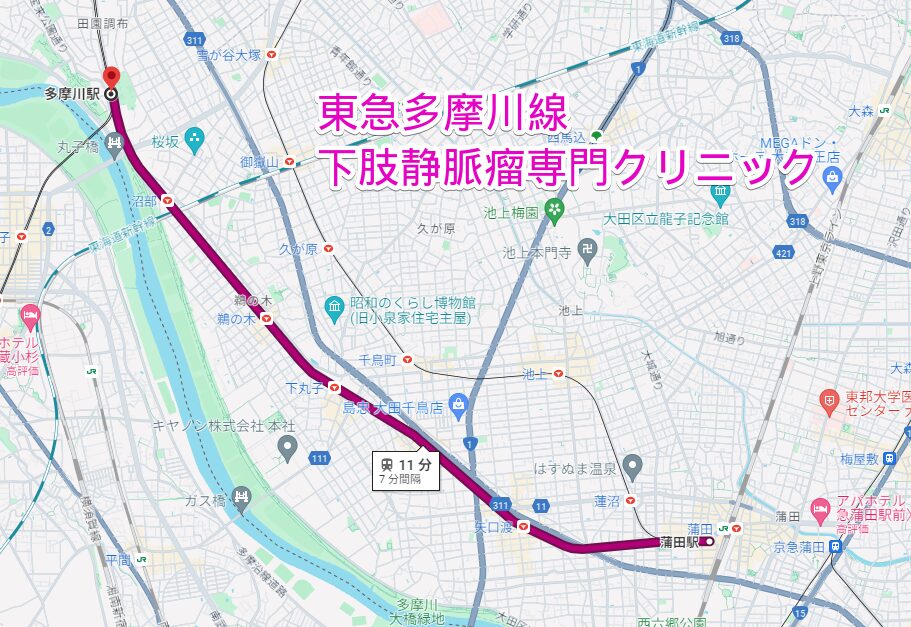 東急多摩川線沿線の下肢静脈瘤専門クリニック