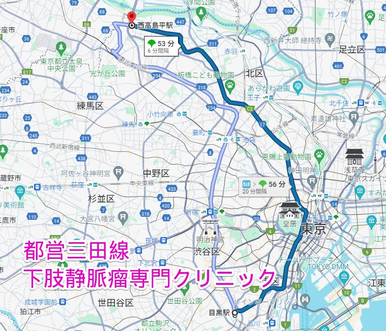 都営三田線沿線の下肢静脈瘤専門クリニック