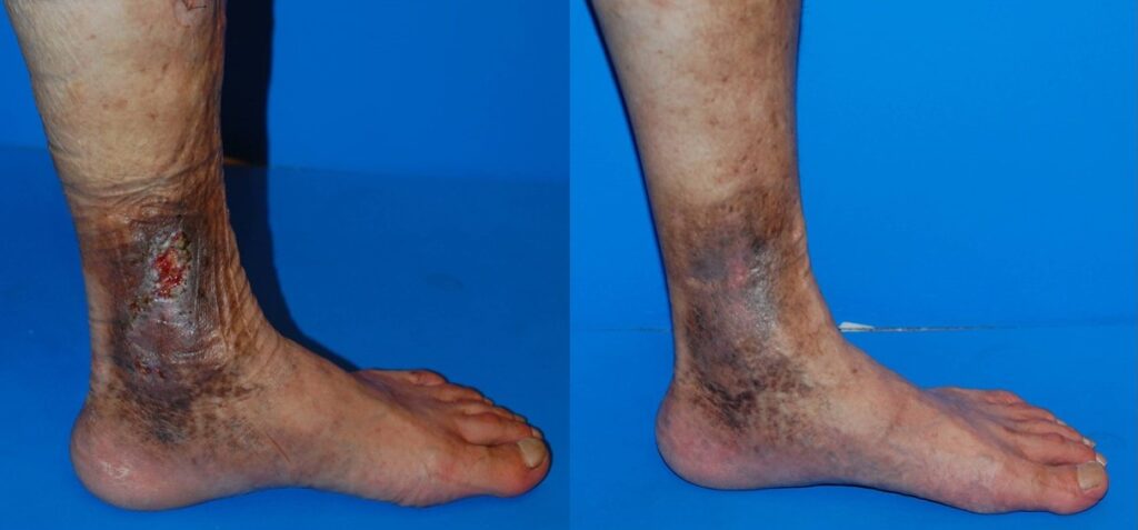 その他のヒント