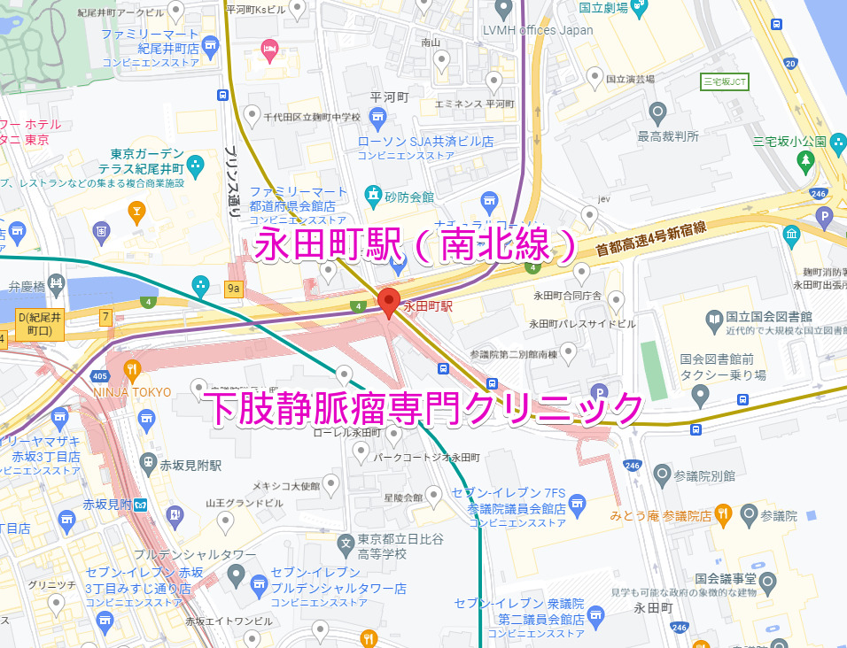 永田町駅 地下鉄南北線 下肢静脈瘤治療専門クリニック