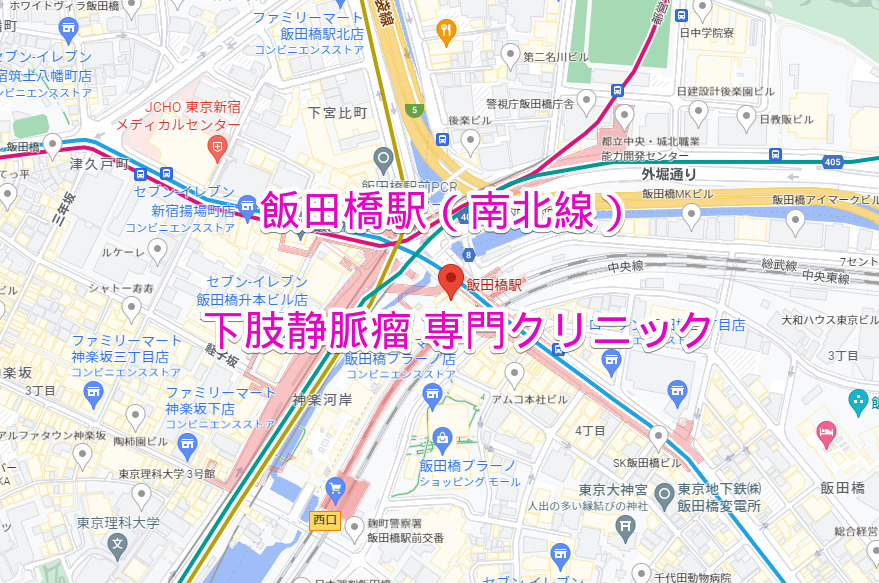 飯田橋駅 地下鉄南北線 下肢静脈瘤治療専門クリニック