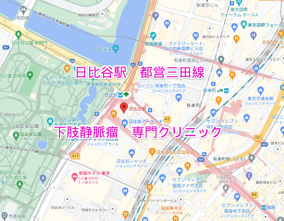 日比谷駅 都営三田線 下肢静脈瘤治療専門クリニック