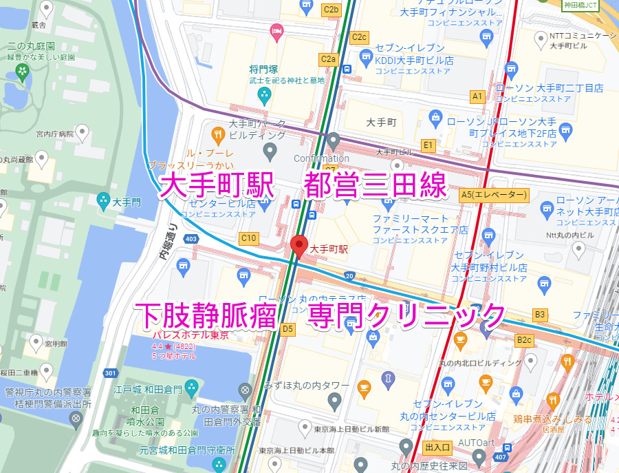 大手町駅 都営三田線 下肢静脈瘤治療専門クリニック