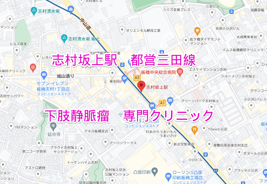 志村坂上駅 都営三田線 下肢静脈瘤治療専門クリニック