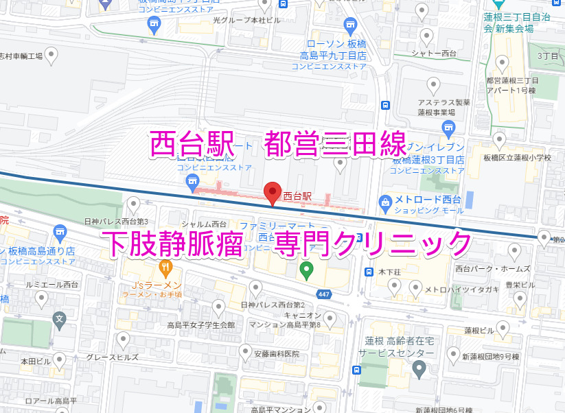 西台駅 都営三田線 下肢静脈瘤治療専門クリニック