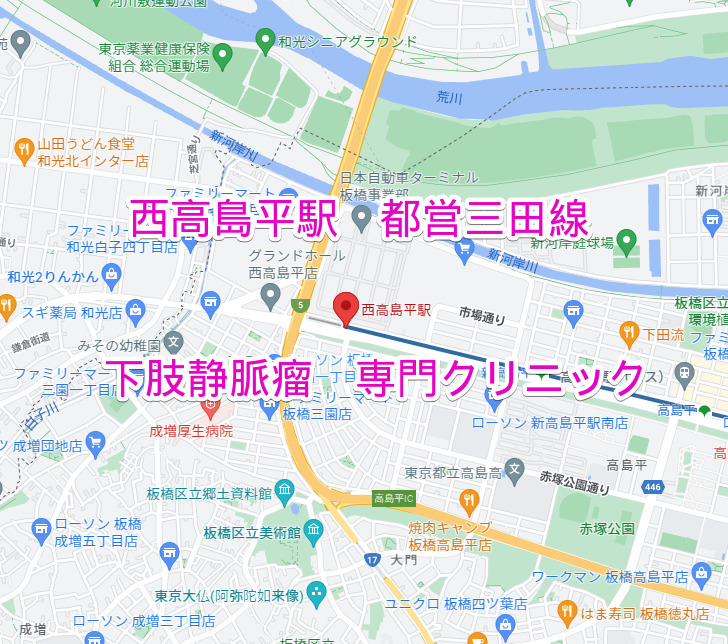 西高島平駅 都営三田線 下肢静脈瘤治療専門クリニック