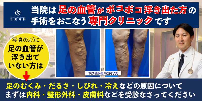 血管が浮き出ていない方は「足のむくみ・だるさ・しびれ・冷え」などの原因についてまずは内科や整形外科、皮膚科などへご相談ください