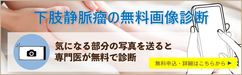 下肢静脈瘤の無料画像診断