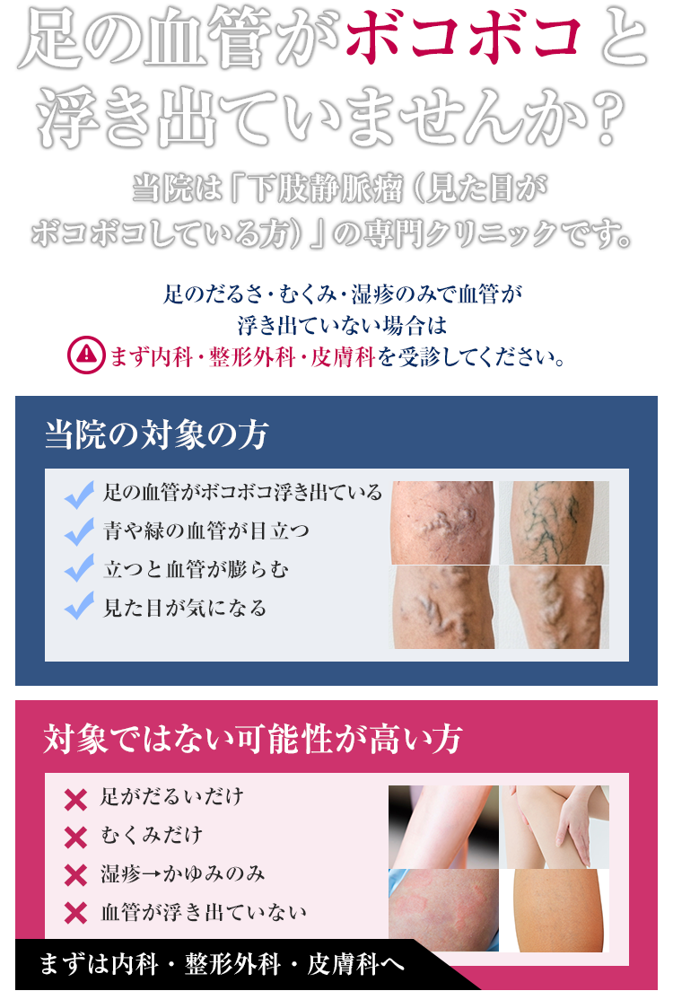 足の血管がボコボコと浮き出ていませんか？