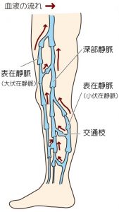 血管内焼灼術について どのような人が手術の対象となる 目黒外科 東京都品川区 目黒駅から徒歩30秒