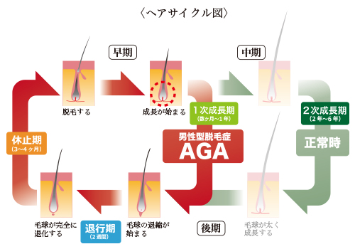 薄毛でお悩みの方必見！】98％の方が効果を実感した薄毛治療とは